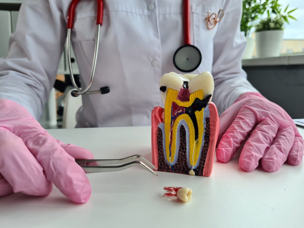 pulpotomy st. peters